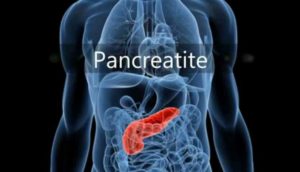 Pancréatite désigne l'nflammation du pancréas 